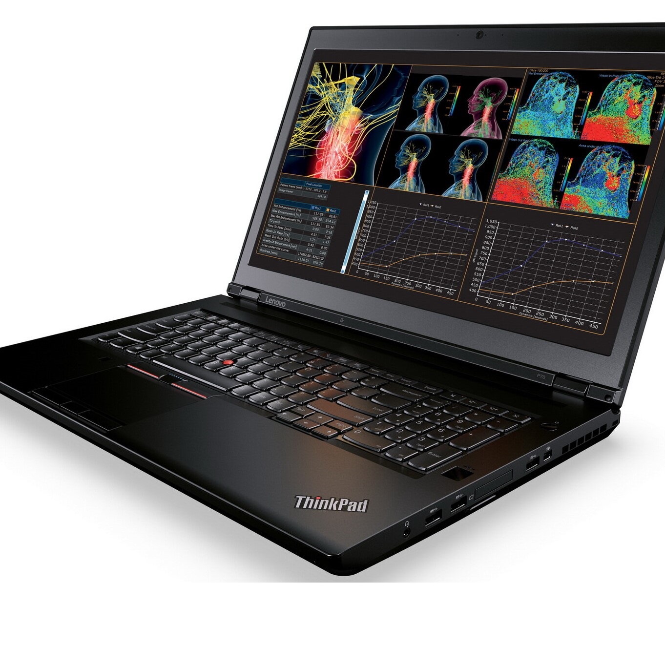 لپ تاپ لنوو مدل Thinkpad P70 i7 16 512